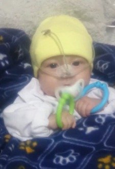 Mathi bebé, en sus primeros meses, durante sus cuidados médicos